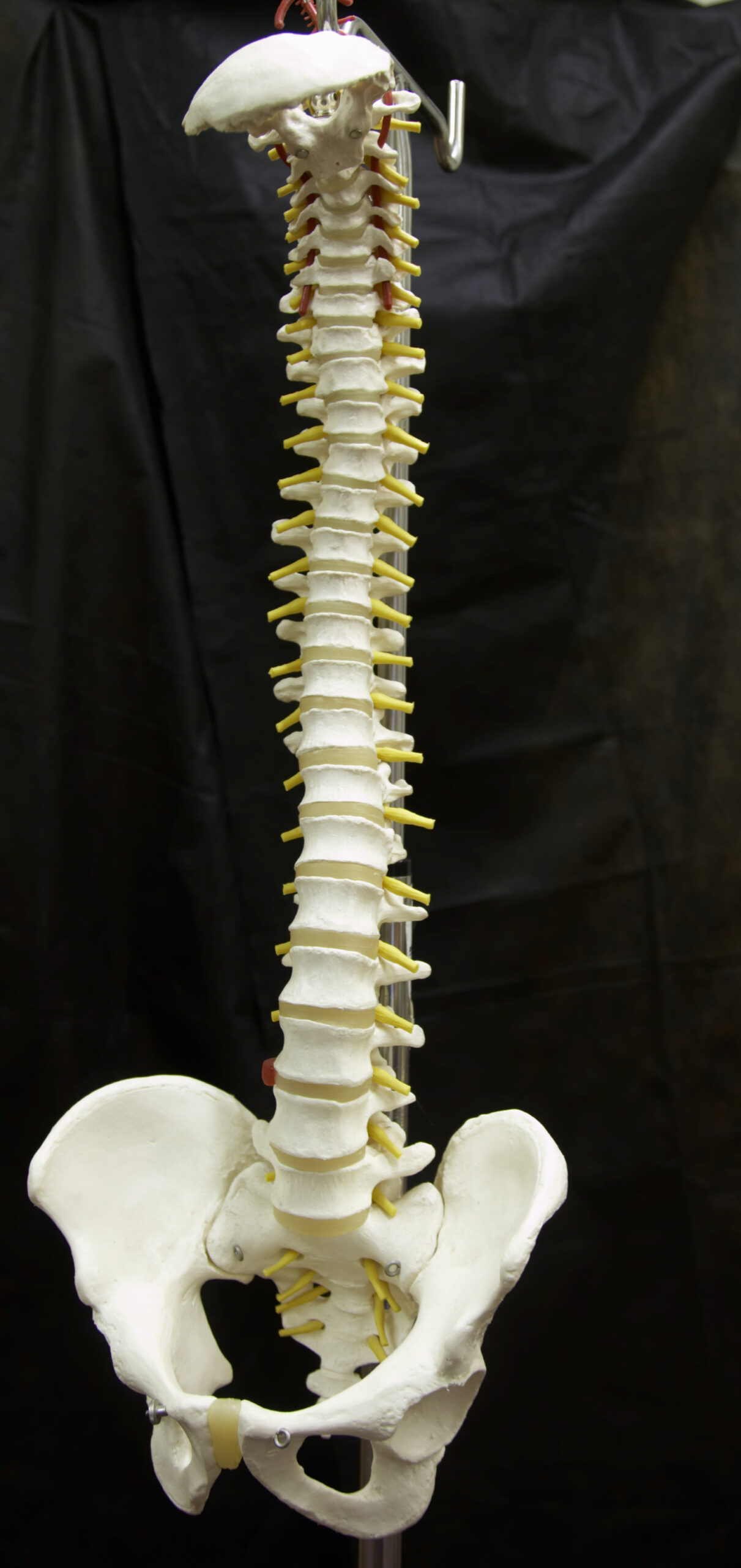 Medical model of spine shown to Little Elm TX patient