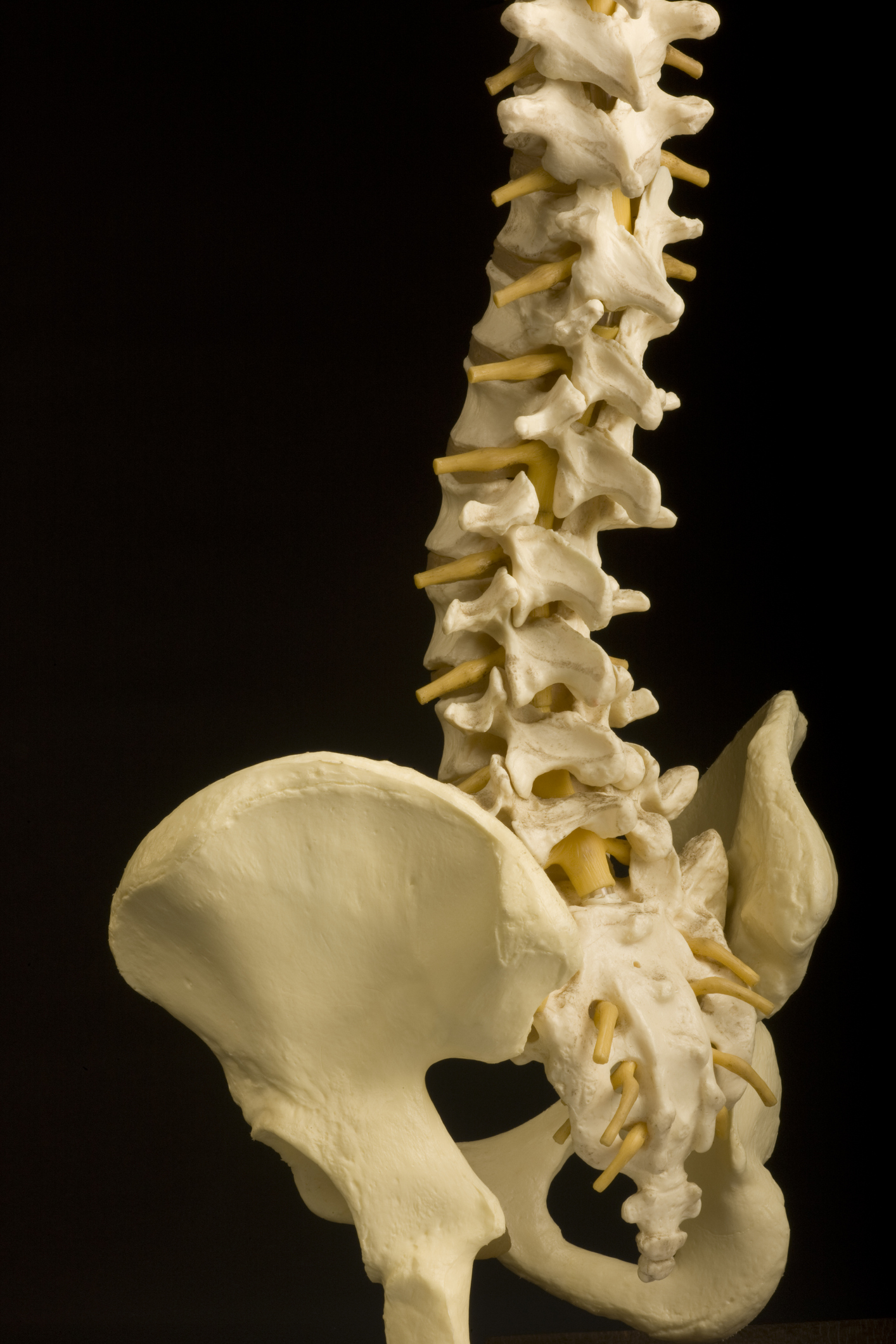 Spine, Pelvis, Coccyx, Chiropractic, Orthopedic, Model for McKinney TX
