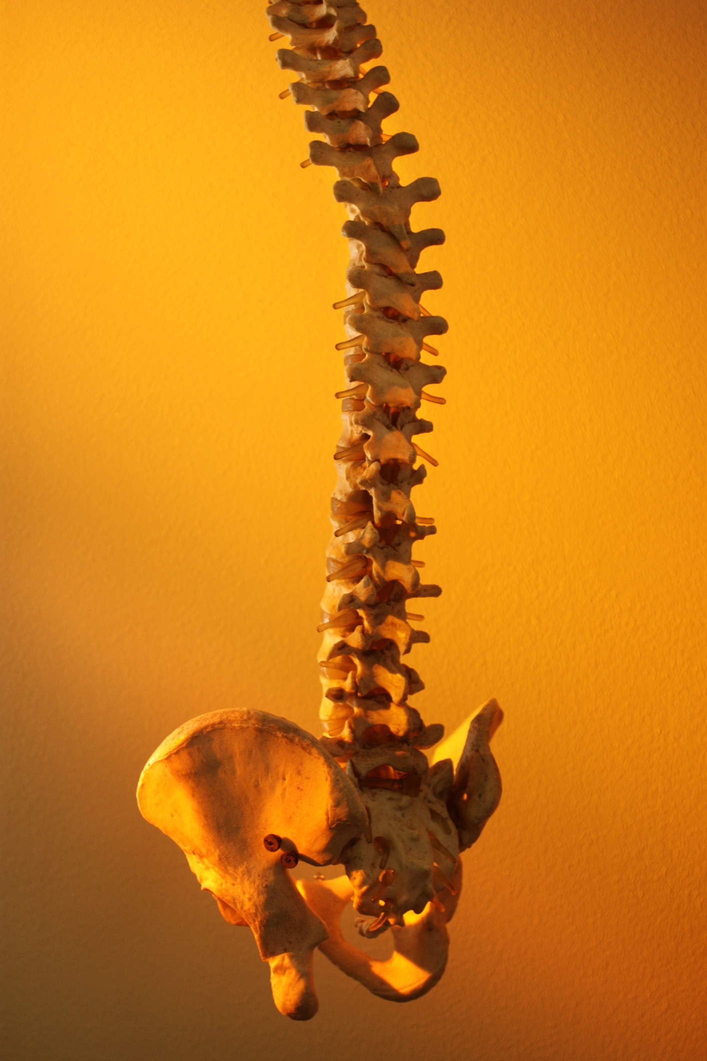 Model of spine shown to Irving TX patients