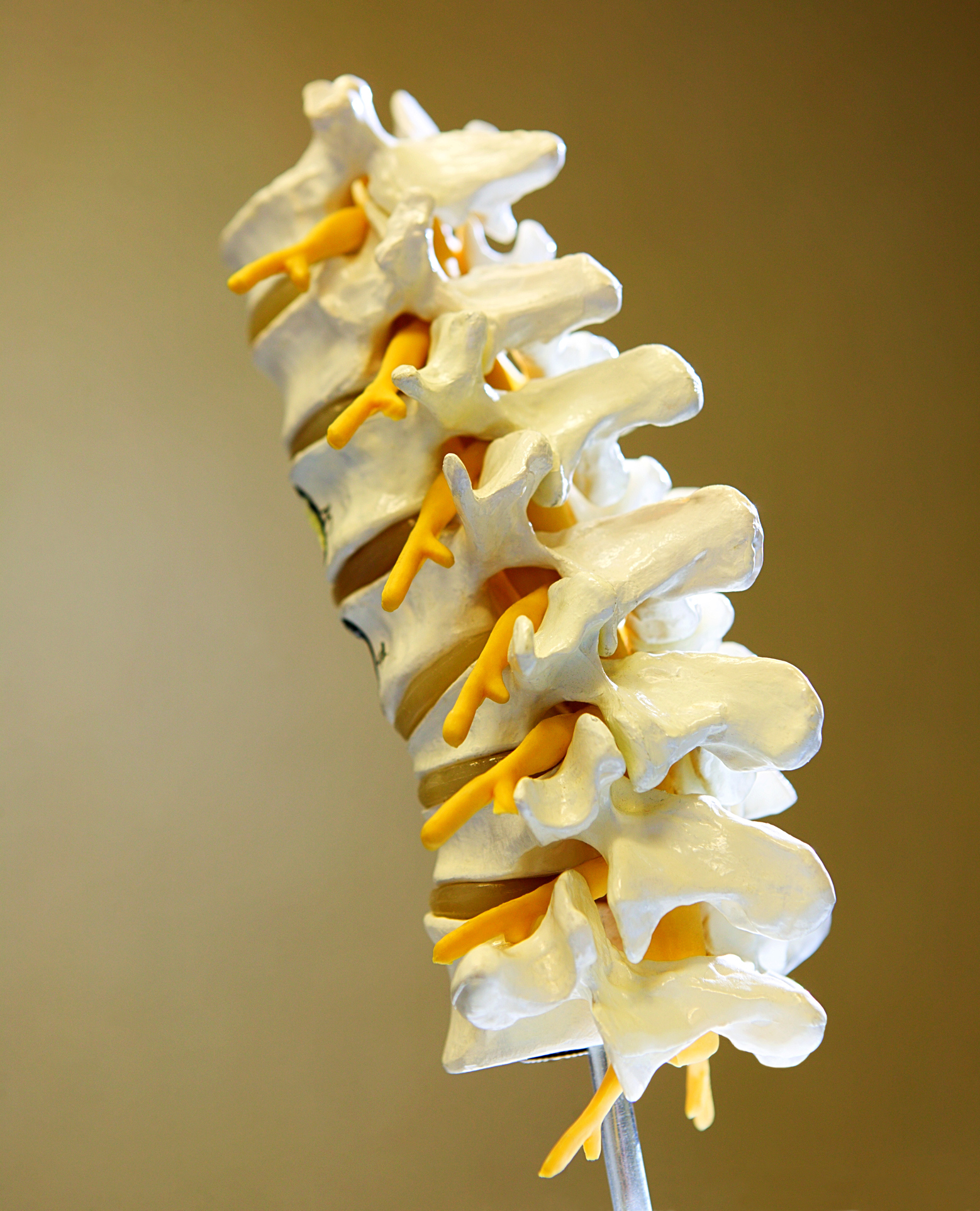 Close-up of a medical model of vertebrae of the spine for Kingston OK patients