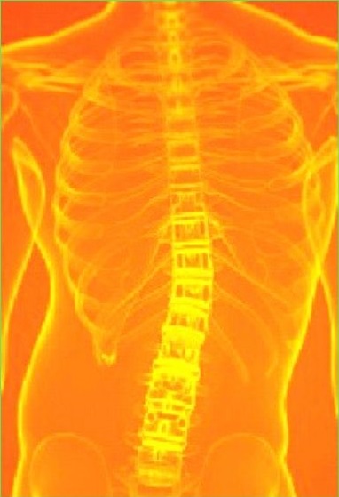 xray of thoracic spine of Frisco TX patient
