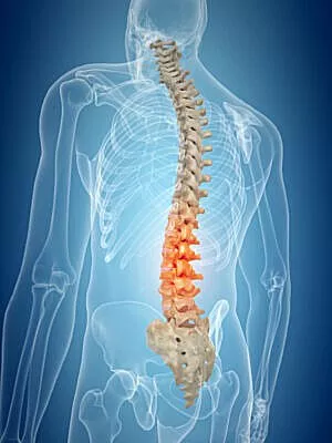 Spine picture displayed to Shreveport LA patient