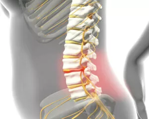 Pain in Spine, illustration