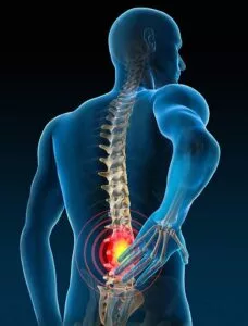 Spinal Pain