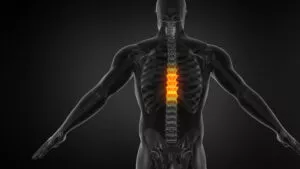 Thoracic Spine Compression