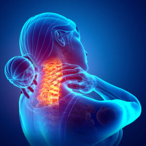 Cervical Spondylotic Myelopathy Cervical Spondylotic Myelopathy 