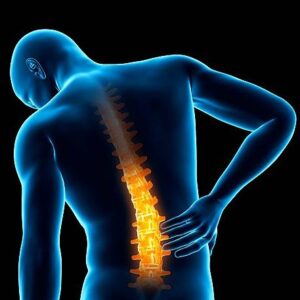 Lumbar Spondylotic Myelopathy
