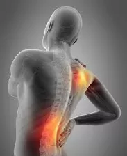 Myofascial Pain