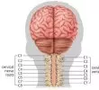 Cervical Spinal Cord Injury