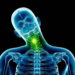 Cervical Spine Tumor