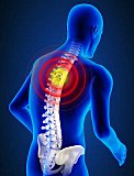 Osteoporotic compression fractures