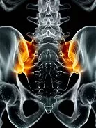 Sacroiliac Joint Dysfunction