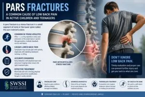 Pars Fracture